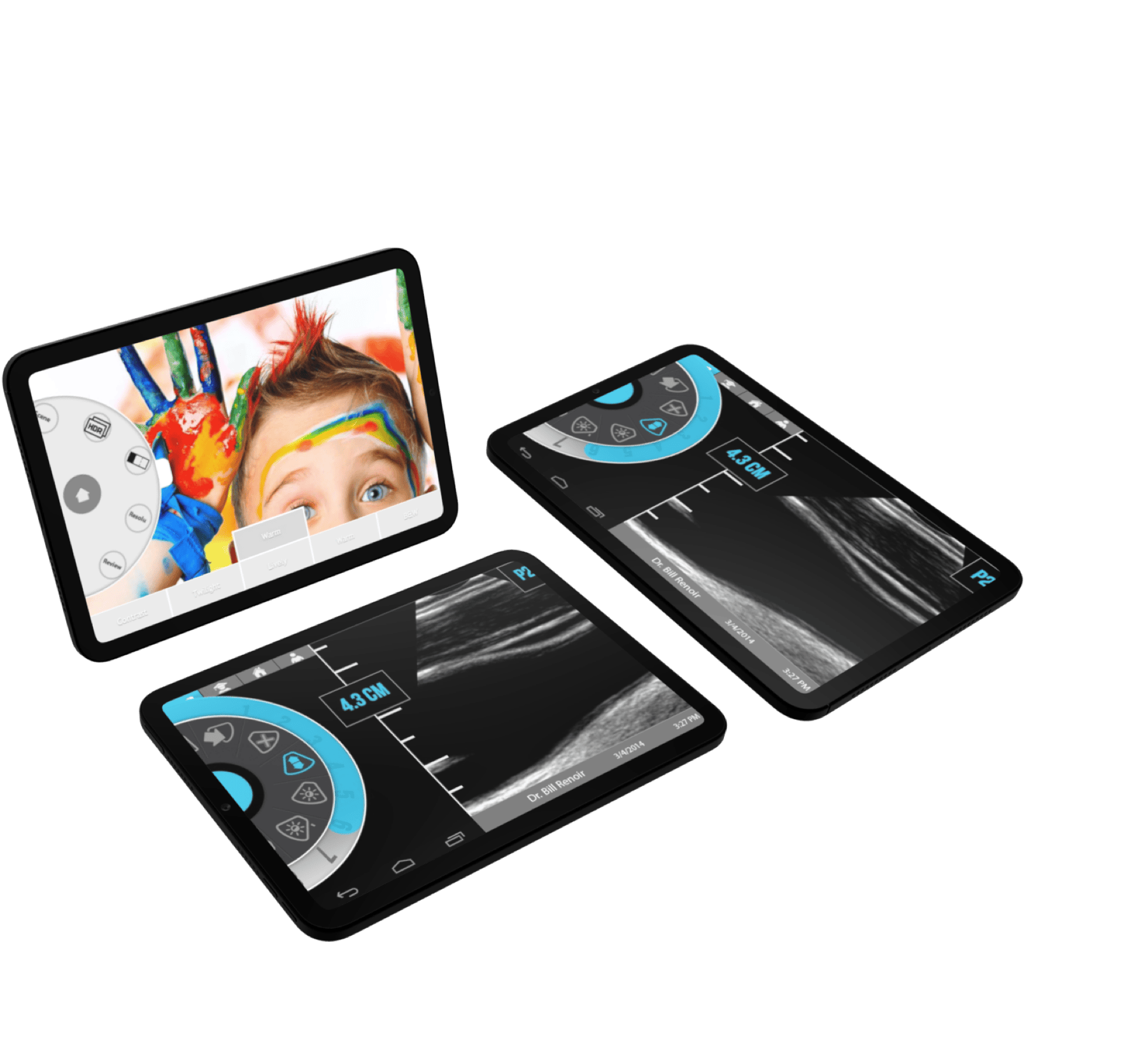 Prototyping the first handheld ultrasound device.